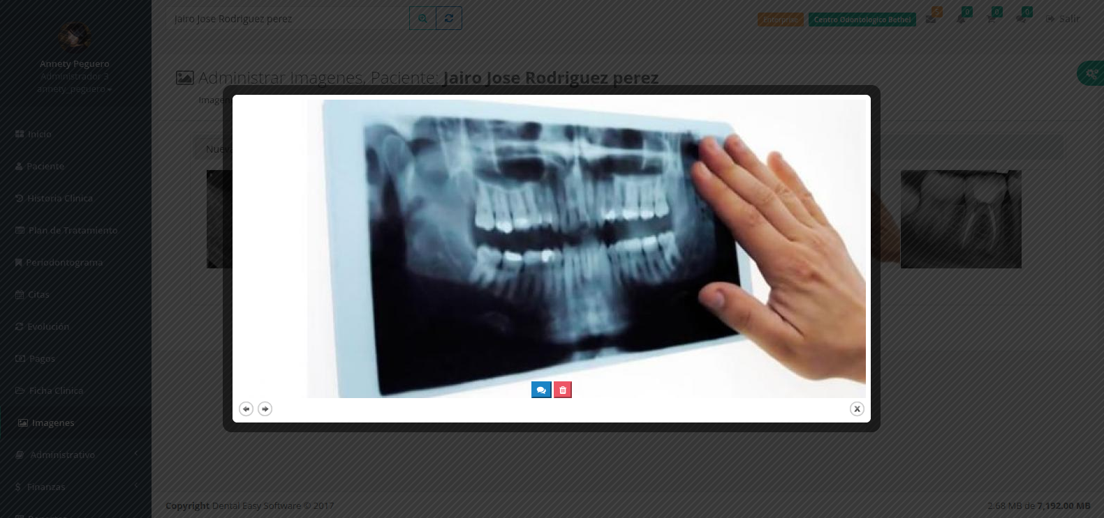 radiografias dentales, Denty Cloud